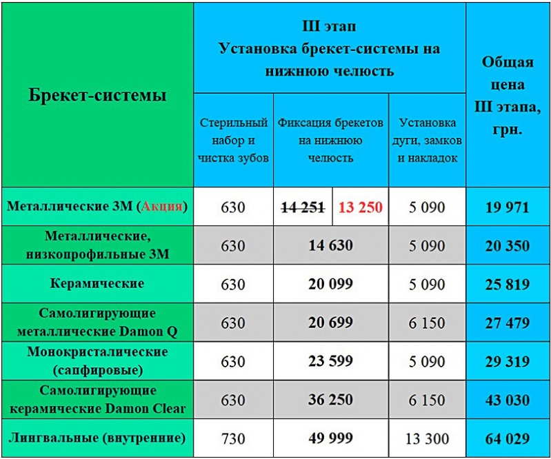 Установка брекет-системы цена Киев ЛюмиДент